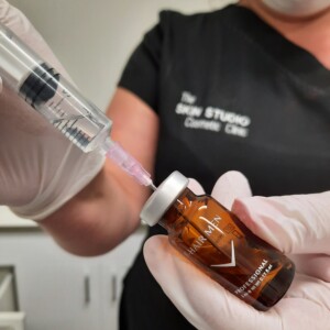 Hair Loss Mesotherapy