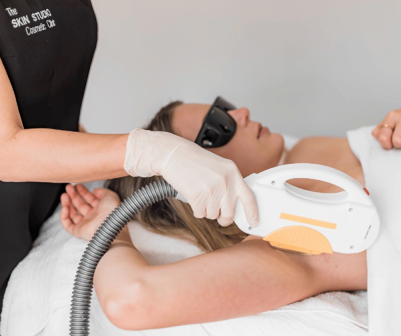 IPL Laser Hair Removal