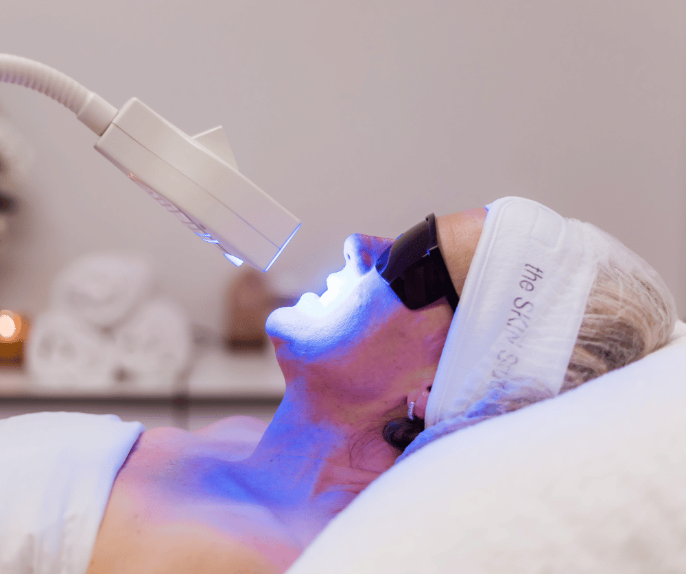 Teeth Whitening Perth