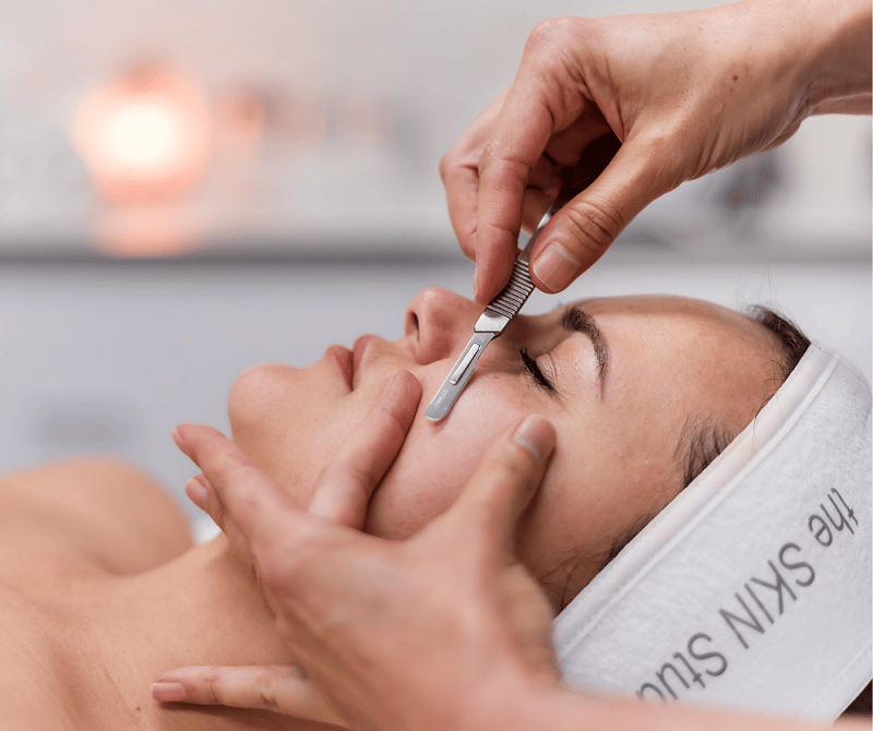 Dermaplaning - Epidermal levelling - Perth