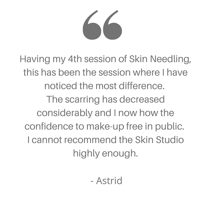 Skin Needling Reviews