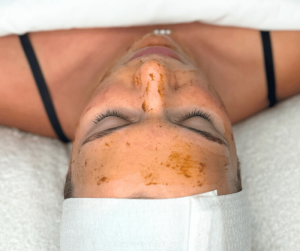 Enzyme Peel