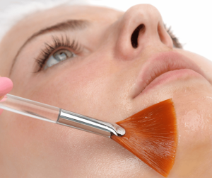 Lactic Peel