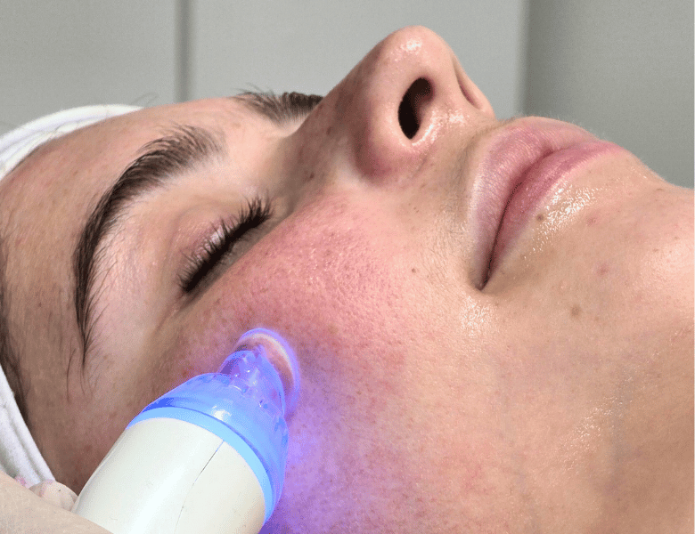 Perth Hydrafacial