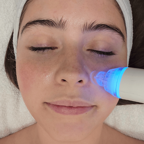 Hydrafacial Perth
