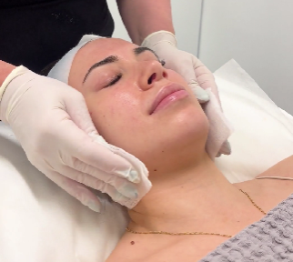 PCA Pigment Correct Peel for Hyperpigmentation