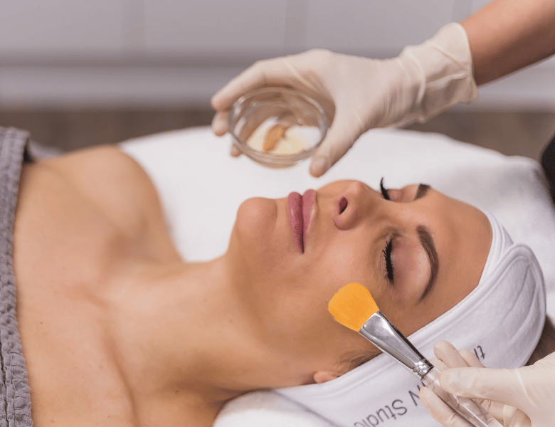 Professional Chemical Peel
