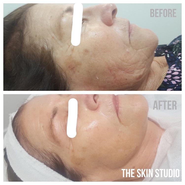 Itchy Skin Menopause Itchy Skin Menopause