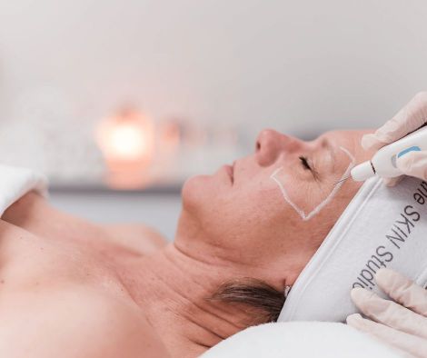 Wrinkles Anti Ageing Treatment Perth